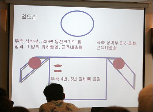 3일 오후 서을 프레스센터에서 열린 '건설노동자 하중근 사망 진상조사단 2차 조사결과 발표 기자회견'에서 고 하중근씨의 부상 상태를 보여주고 있다. 